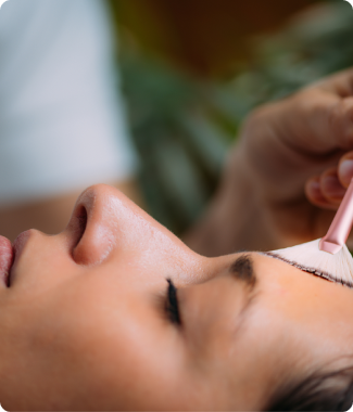 Chemical Peels