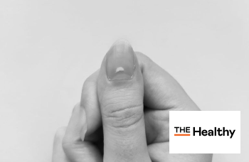Here’s What It Means if You Have White Spots on Your Nails