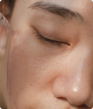 Non Surgical Facelift(PRP)
