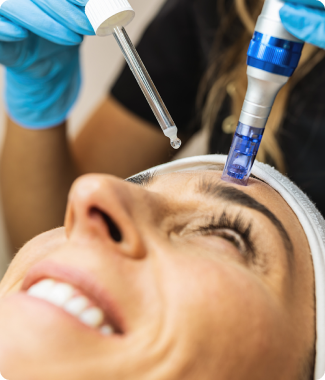 Vampire Facial